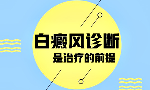 湖州专业治疗白癜风,如何治疗白癜风防止其扩散?