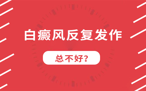 杭州去哪检查白癜风要多少钱,白癜风的同形反应是什么