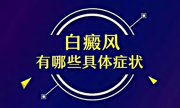 绍兴好的白癜风医院在哪儿,手部白癜风皮肤有什么症状?