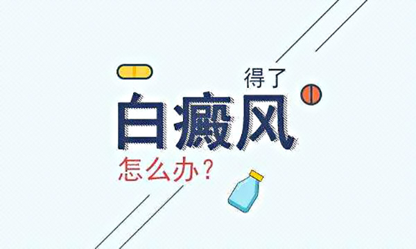 女性白癜风该怎么治疗呢？