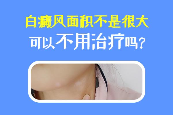 小面积白斑还有必要治疗吗?